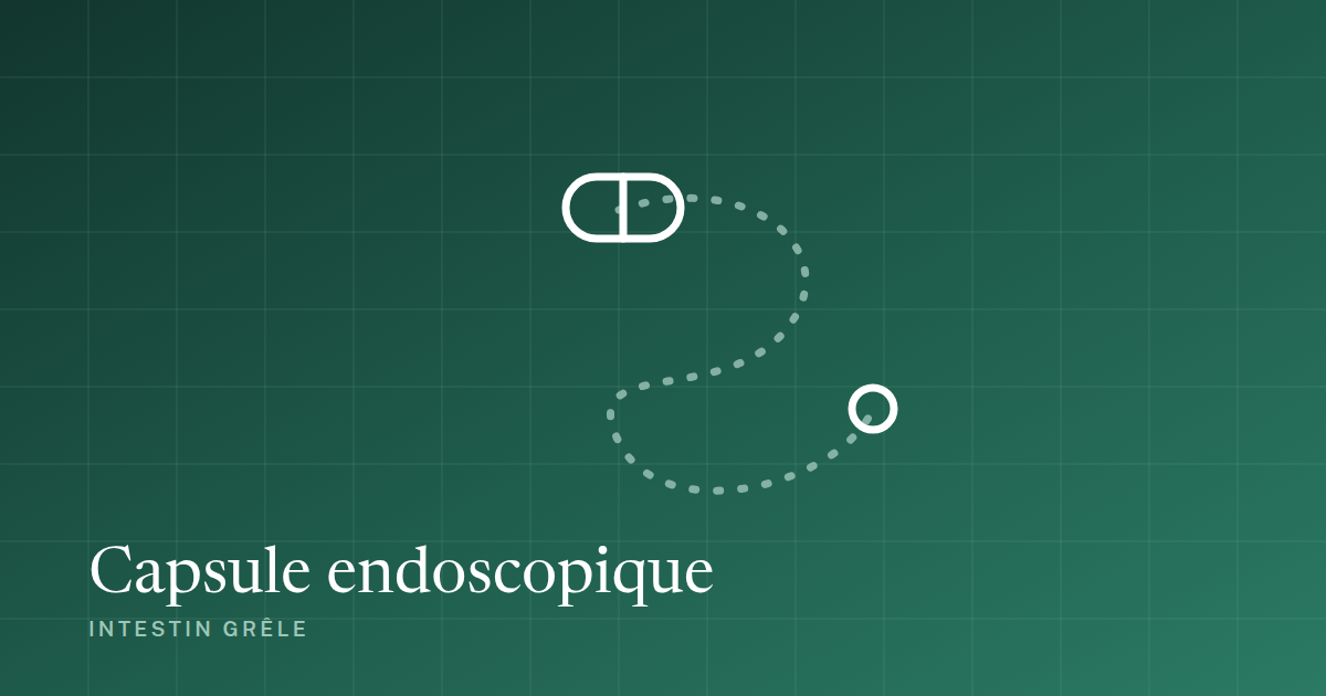 Capsule endoscopique : schema de l'examen