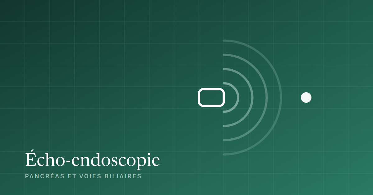 Écho-endoscopie : schema de l'examen