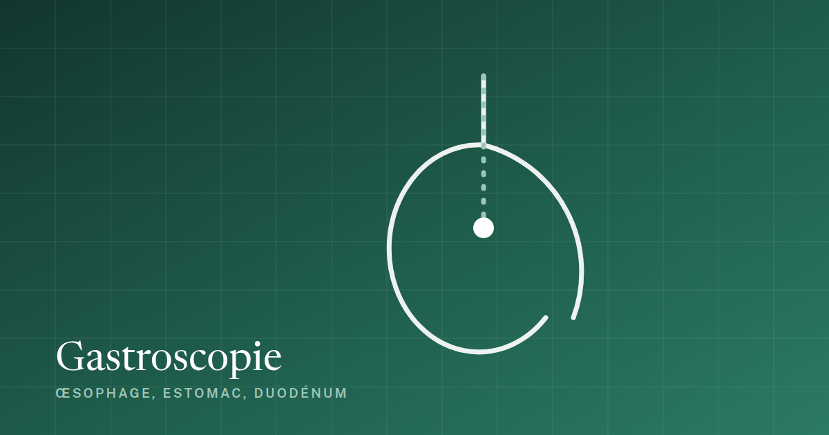 Gastroscopie : schema de l'examen